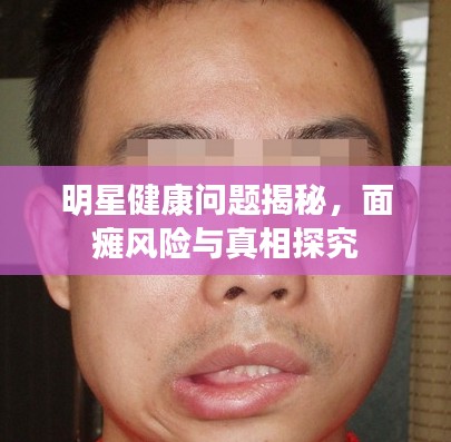 明星健康问题揭秘，面瘫风险与真相探究